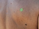 leaf on skin